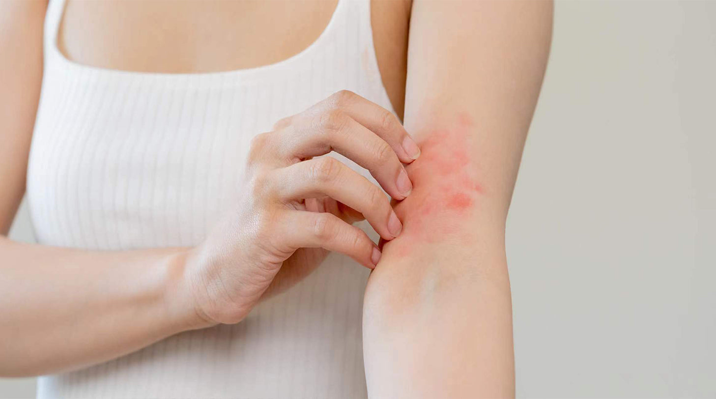 Can a Humidifier Help With Eczema?